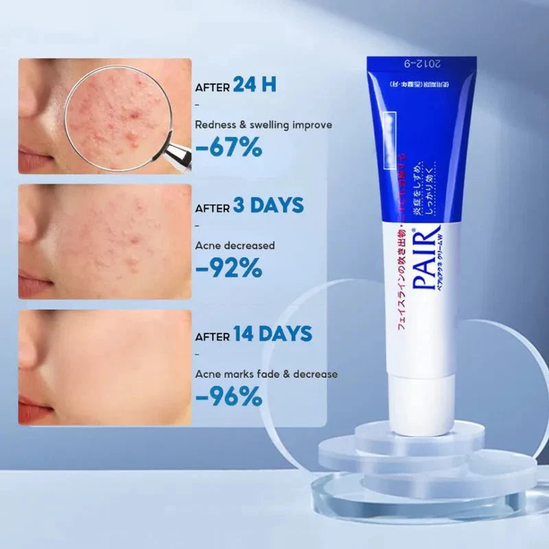 LION - Pair Acne Cream 24g