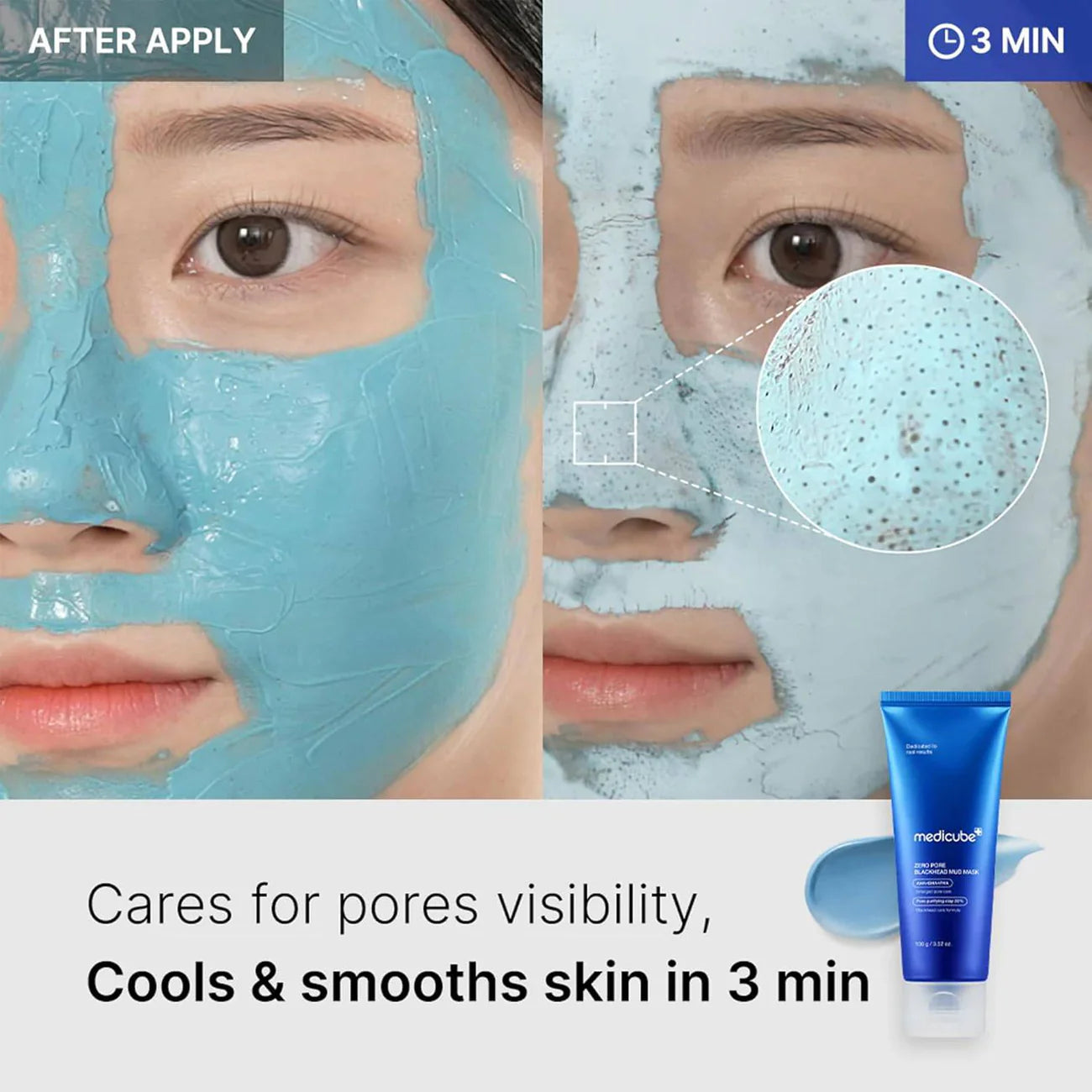 MEDICUBE ZERO PORE BLACKHEAD MUD MASK 100G